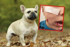 Brutalny atak psa na dziecko. Rodzice pilnie szukają właściciela