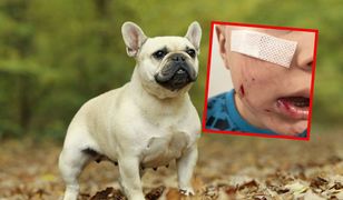 Brutalny atak psa na dziecko. Rodzice pilnie szukają właściciela