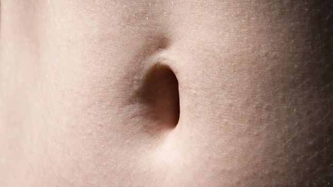 Guz w pępku może być objawem nowotworu