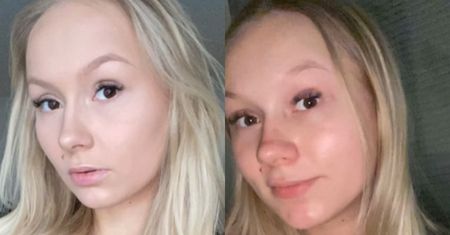 Kobiety narzekają na "ciążowy nos". Lekarze wyjaśniają fenomen