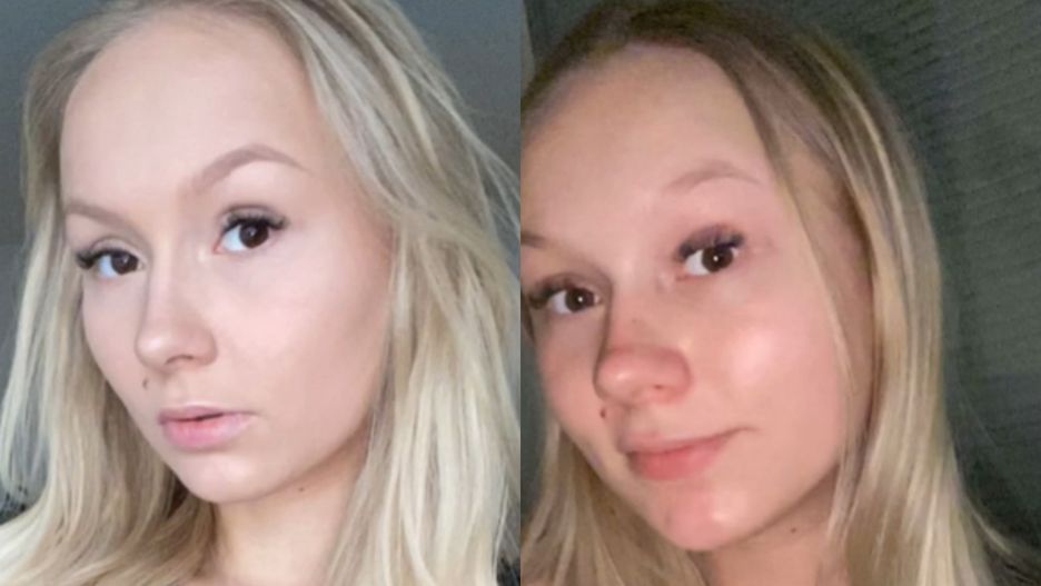 Kobiety na TikToku pokazują "ciążowe nosy"