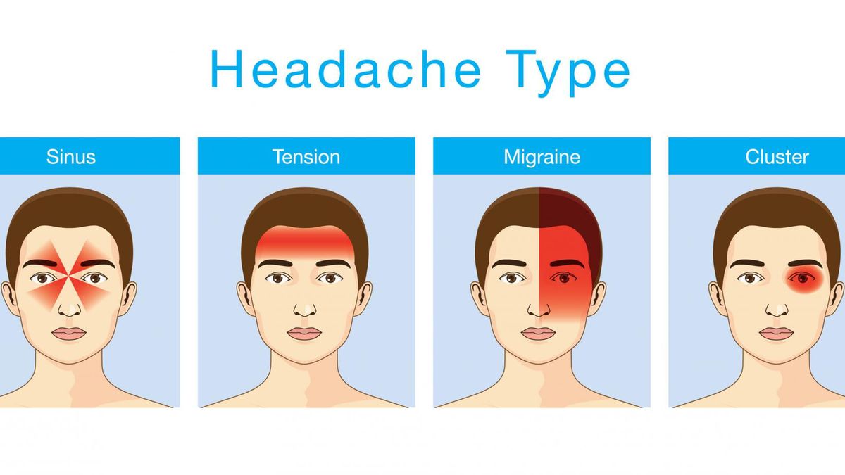 Rodzaje bólu głowy