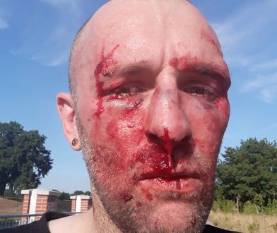 Przemysław Witkowski po pobiciu we Wrocławiu