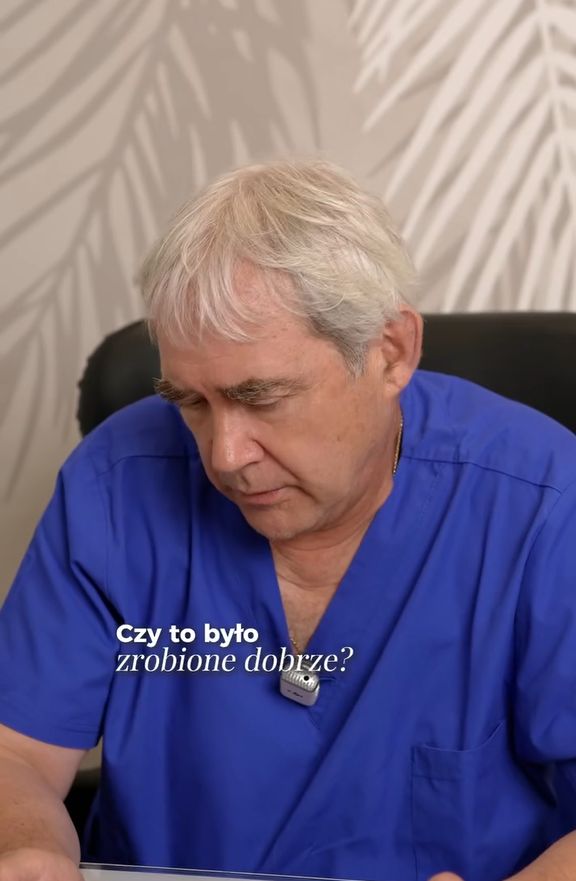 Specjalista przeanalizował przemianę twarzy Małgorzaty Rozenek