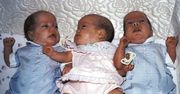 Afganka urodziła sześcioraczki - została bohaterką