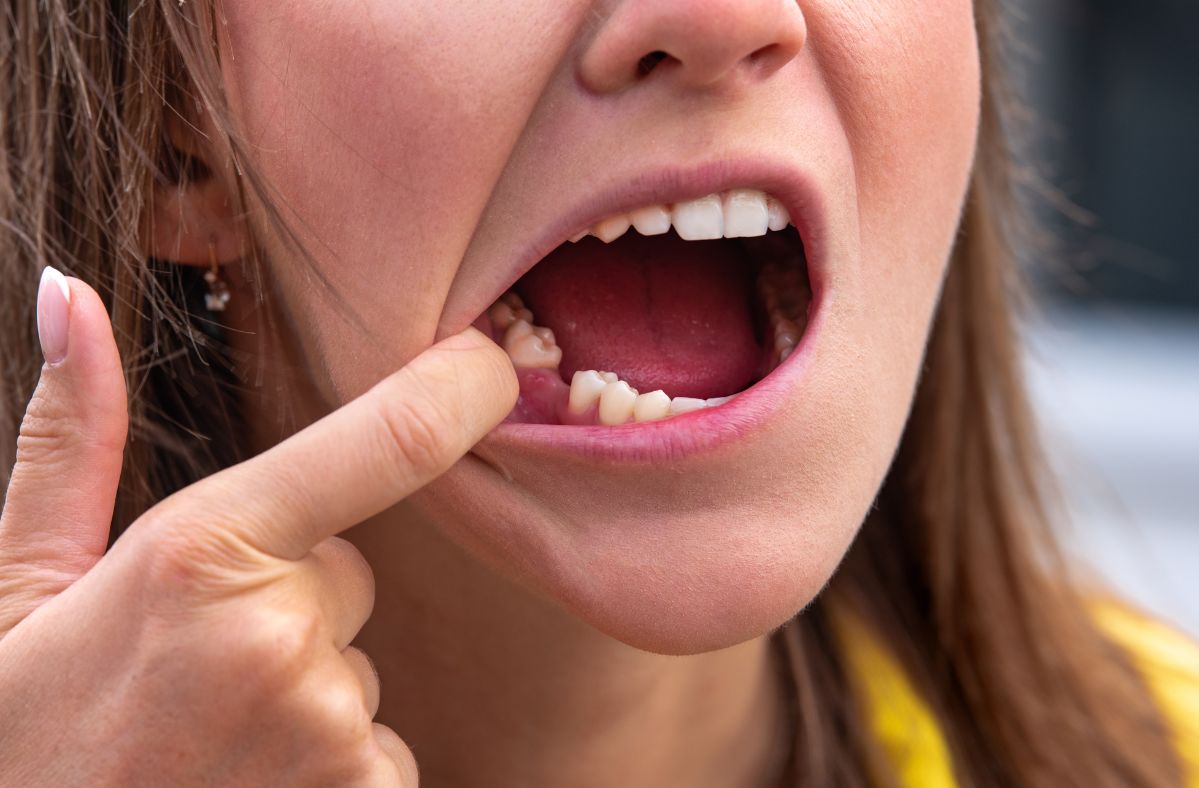 Japanese scientists begin trials for revolutionary tooth regrowth drug