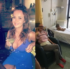 Podczas opalania zauważyła siniaki na ciele. Nie sądziła, że to objaw białaczki