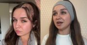 Robiła ciasto na święta, przeżyła horror. Sprzęt "pożarł" jej włosy