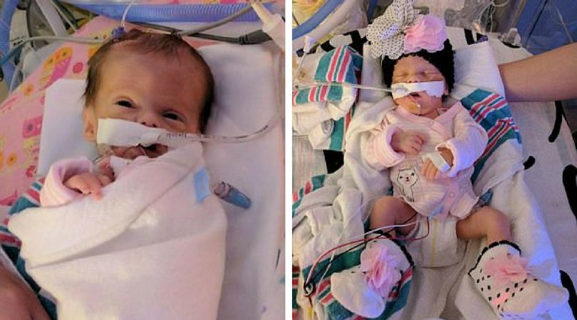 (Facebook.com) Addison urodziła się z guzem, którego do dziś lekarze nie są w stanie zdiagnozować