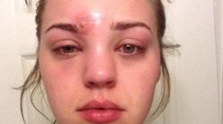 Oto czym może się skończyć używanie brudnych pędzli do makijażu! 21-latka omal nie umarła!