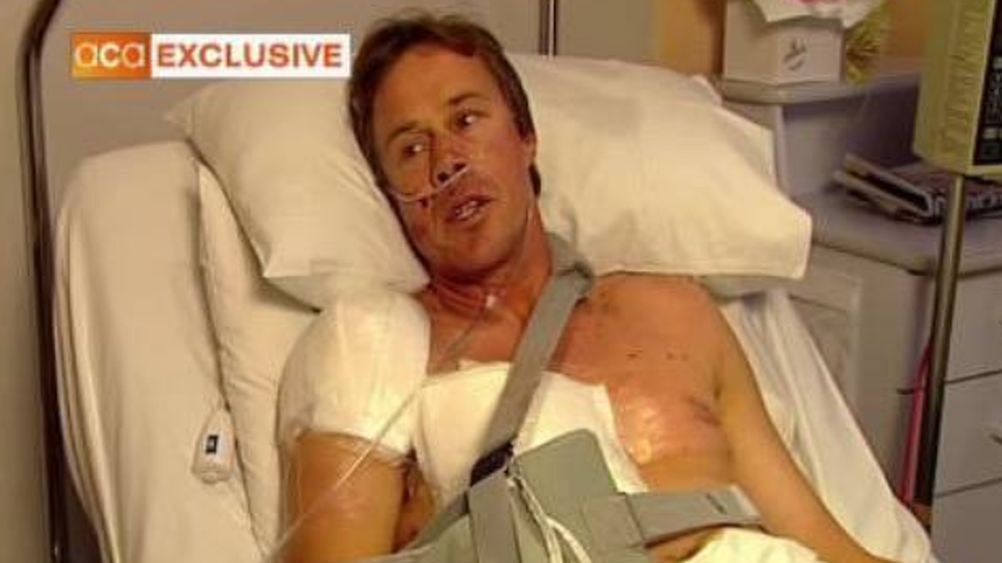 Rekin połknął mężczyznę, ale zdołał przeżyć. Opowiada o traumatycznym wydarzeniu.