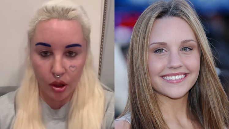 Odmieniona Amanda Bynes wróciła na media społecznościowe 