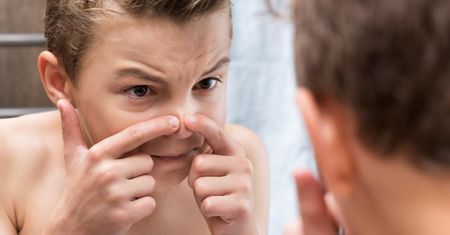 Próbujesz wyciskać krostki na twarzy? Uważaj na trójkąt śmierci (WIDEO)
