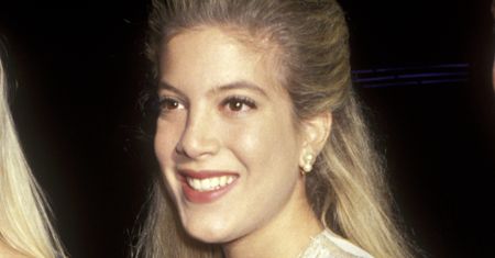 Tori Spelling bez filtra. Tak wygląda jej twarz po kolejnych operacjach