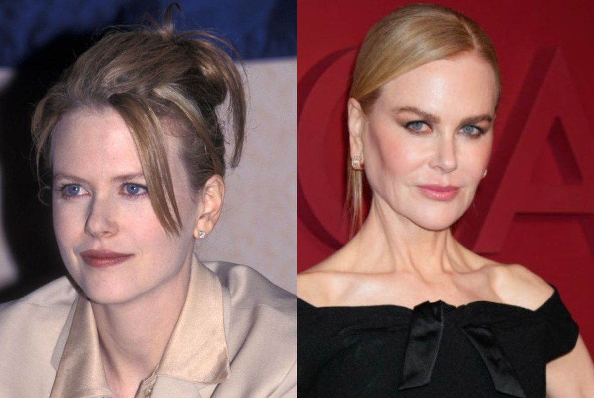 Tak zmieniały się uszy Nicole Kidman