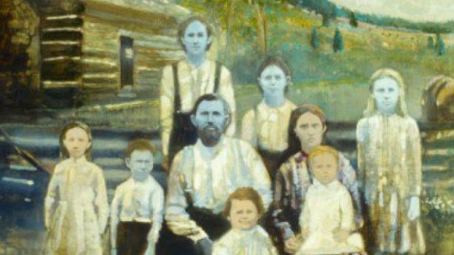 Noworodek z niebieską skórą. Lekarze byli w szoku