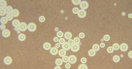 Cieplejszy klimat to większe zagrożenie ze strony grzybów