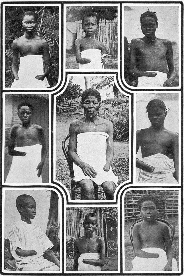 Dzieci z Kongo Belgijskiego okaleczone przez siły kolonialne