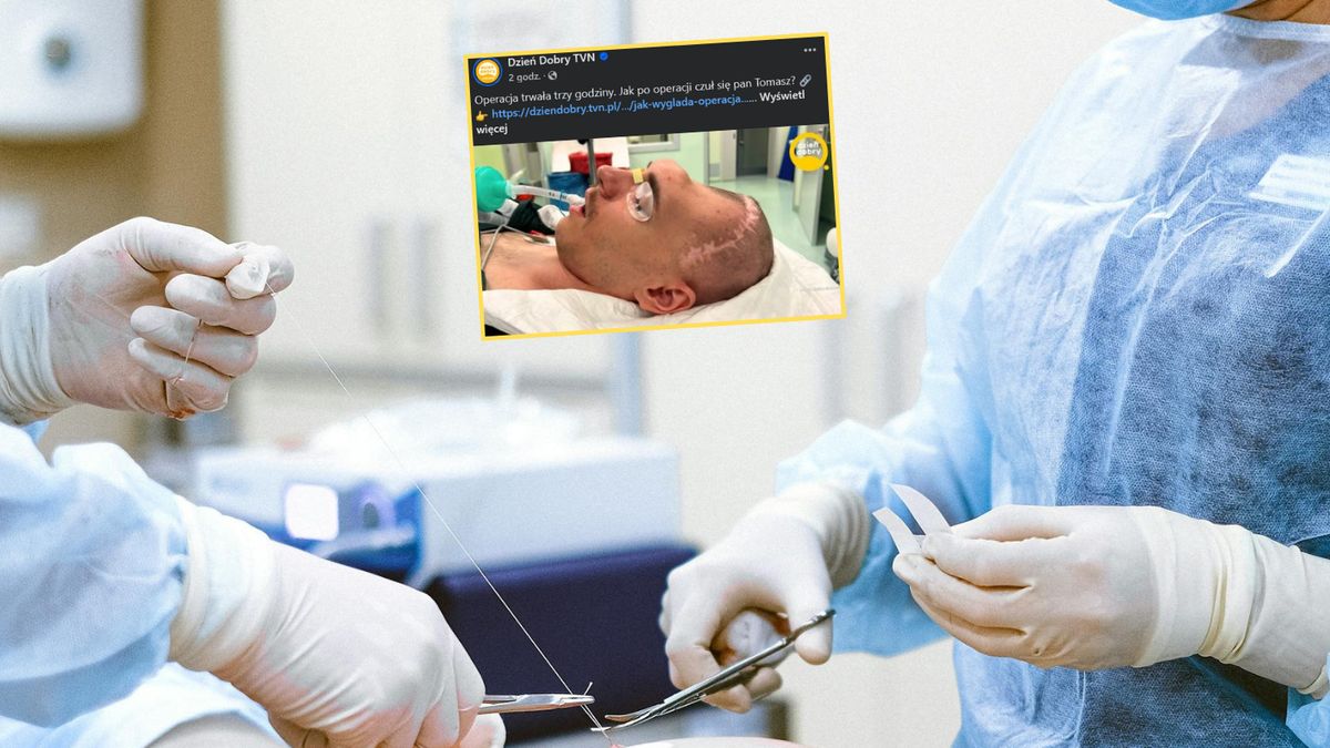Rekonstrukcja czaszki to szansa na powrót do normalności