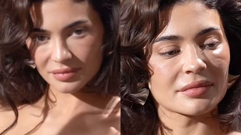 Internauci zaniepokojeni, co dzieje się z twarzą gwiazdy. Zainwestowała w wypełniacze? Zagraniczna ekspertka ocenia