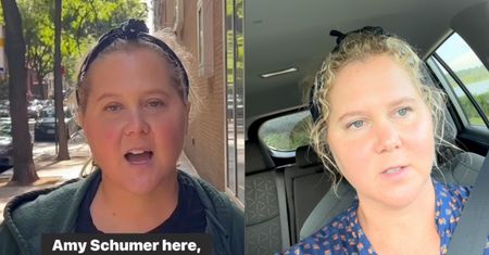 Wszyscy komentują jej spuchniętą twarz. Amy Schumer przerywa milczenie