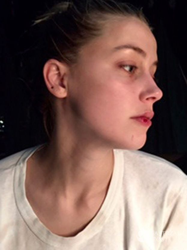 Posiniaczona Amber Heard