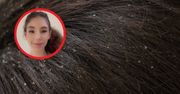 Fryzjerka się przeraziła. Wstrząsające odkrycie na głowie 13-latki