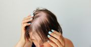 Łysienie u kobiet - jakie są najczęstsze przyczyny? Jakie badania wykonać?
