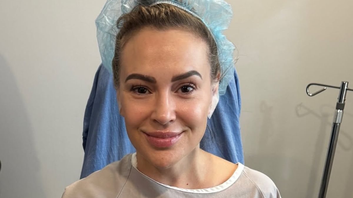 Alyssa Milano pozbyła się implantów