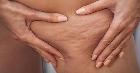Tajna broń w walce z cellulitem. Wiele osób ma w ogrodzie tę niepozorną roślinę