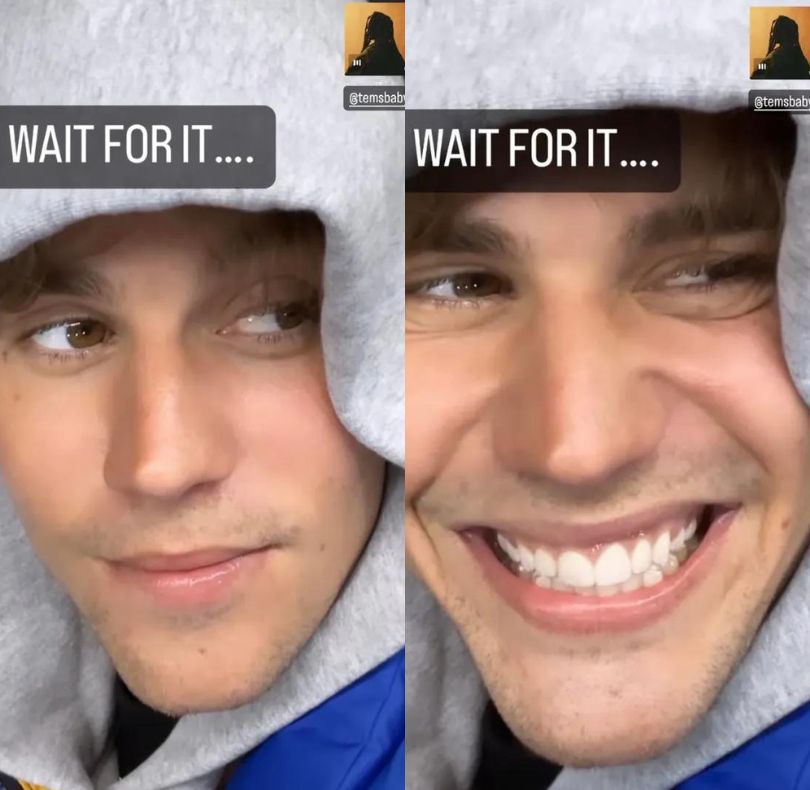 Justin Bieber walczył z chorobą. Co mu dolegało?