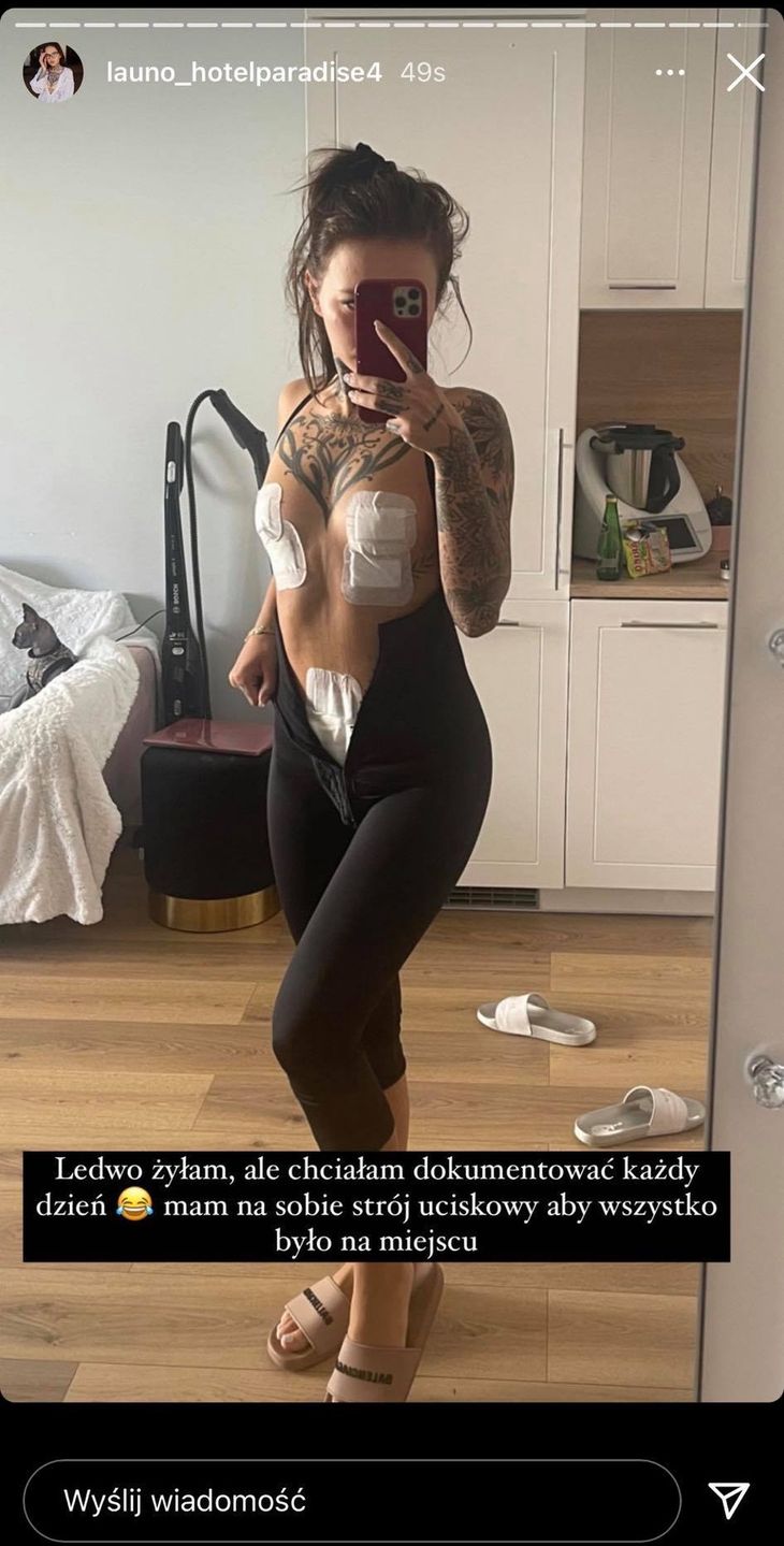 Klaudia z "Hotelu Paradise" po operacji plastycznej