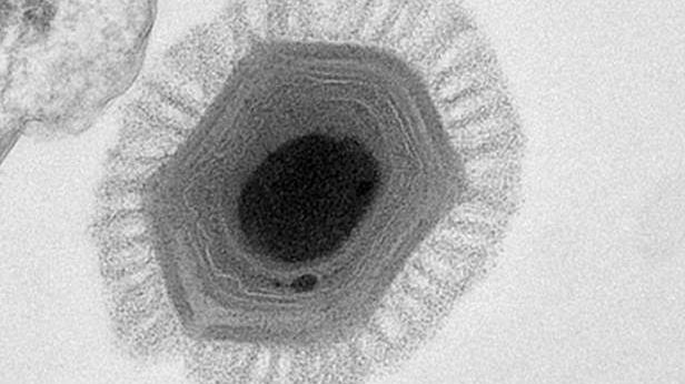 W wodzie odkryto wirusa o rekordowych rozmiarach 1