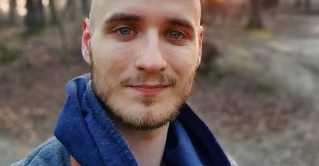 Przeszczepił włosy w Turcji. Aktor pokazał efekt końcowy