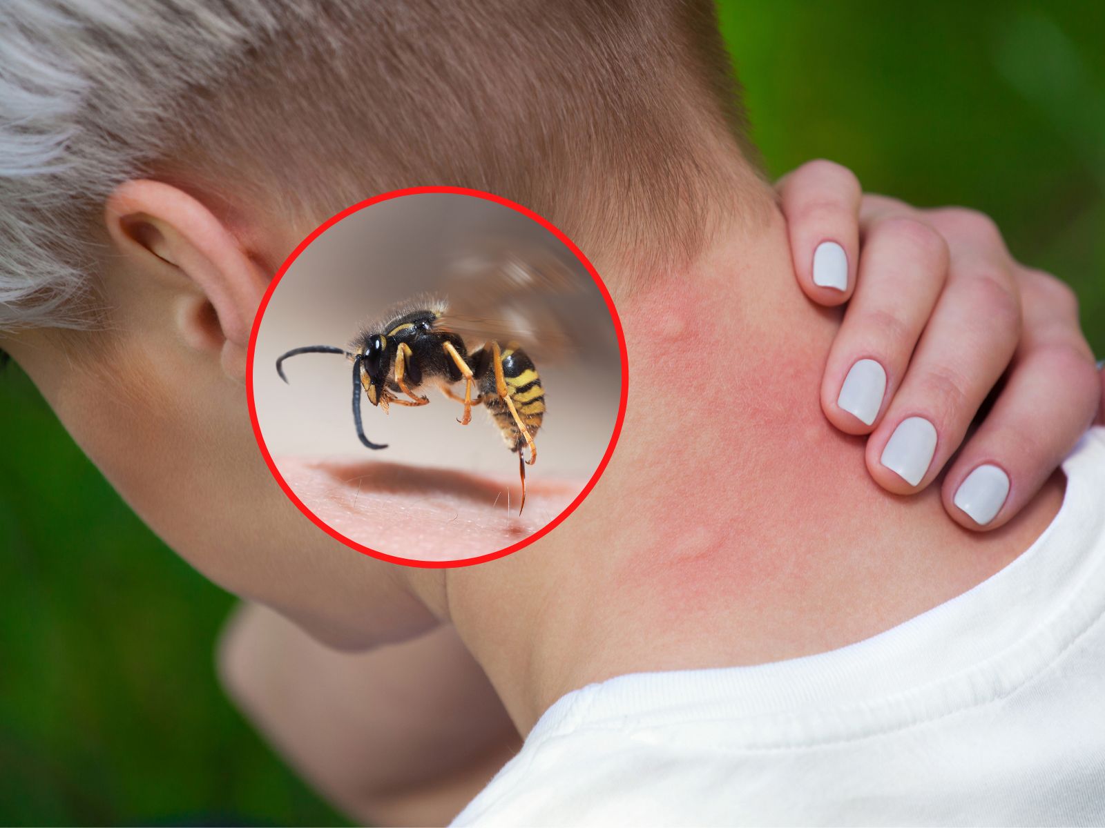 Skuteczne sposoby na użądlenie osy. Ból zniknie w kilka sekund