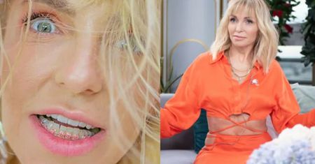 Anna Wyszkoni w aparacie ortodontycznym reaguje na komentarze dotyczące odmienionego wyglądu: "Ja i moja NOWA TWARZ..." (FOTO)