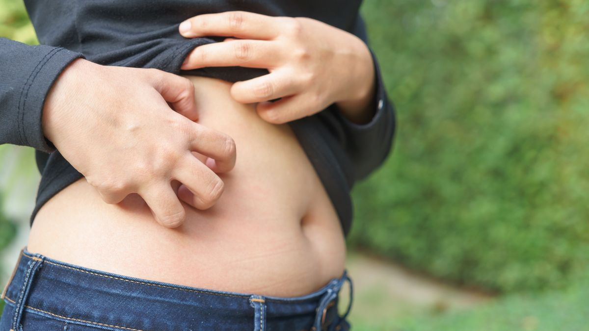 Midsection Of Woman Scratching Stomach Outdoors
Kittisak Jirasittichai / EyeEm