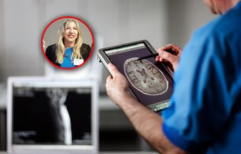 Menopauza w mózgu. Badanie wykazało zmiany podobne do tych w alzheimerze