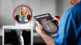 Menopauza w mózgu. Badanie wykazało zmiany podobne do tych w alzheimerze