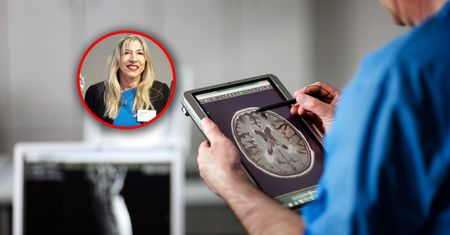 Menopauza w mózgu. Badanie wykazało zmiany podobne do tych w alzheimerze