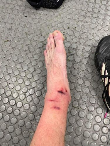 Zdjęcie nogi Sebastiana Walukiewicza przesłane do redakcji WP SportoweFakty