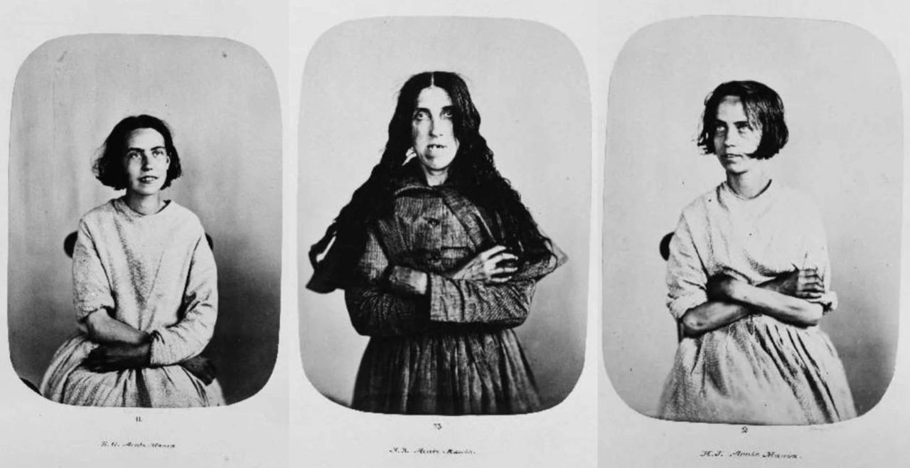 Historyczne portrety pacjentów szpitala psychiatrycznego z horrorów
