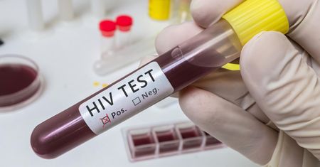 Przełom w badaniach nad HIV. Odkryto, jak wirus integruje się z DNA człowieka