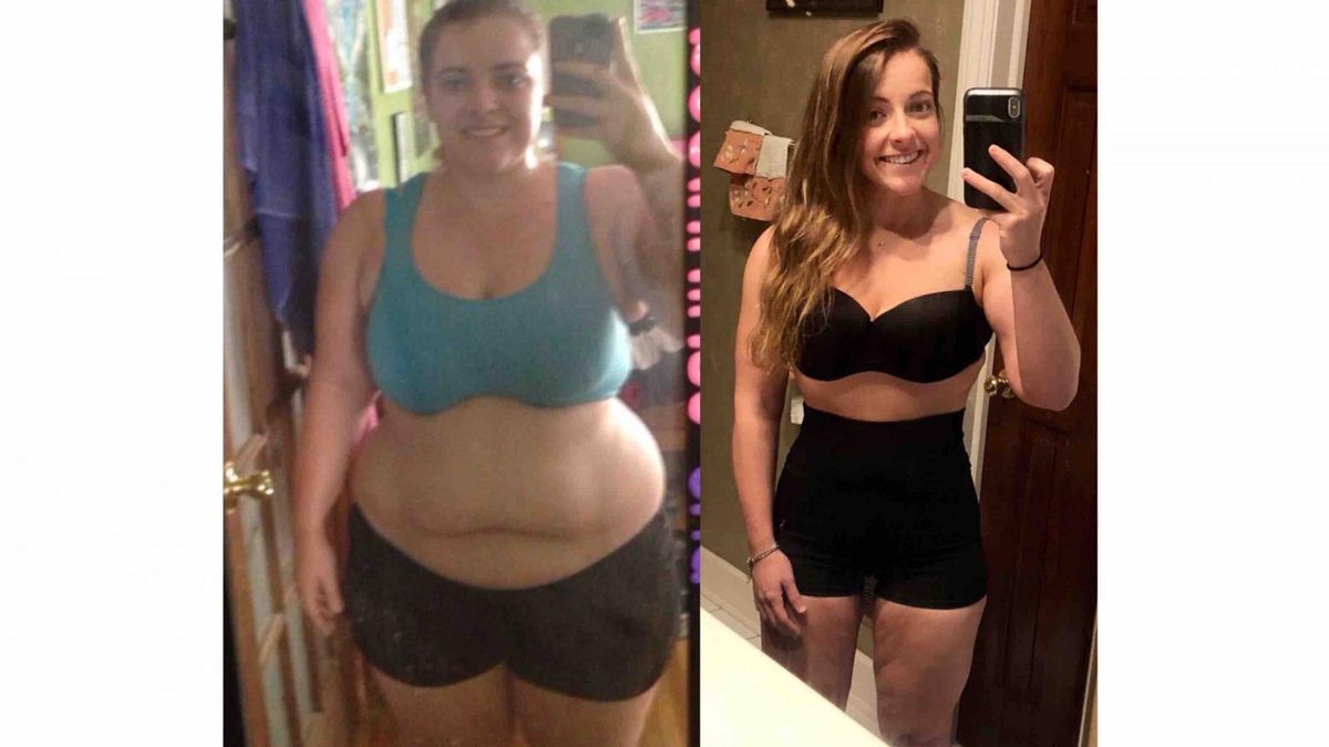 Kayla była zmotywowana, aby schudnąć bez konieczności ingerencji chirurgicznej