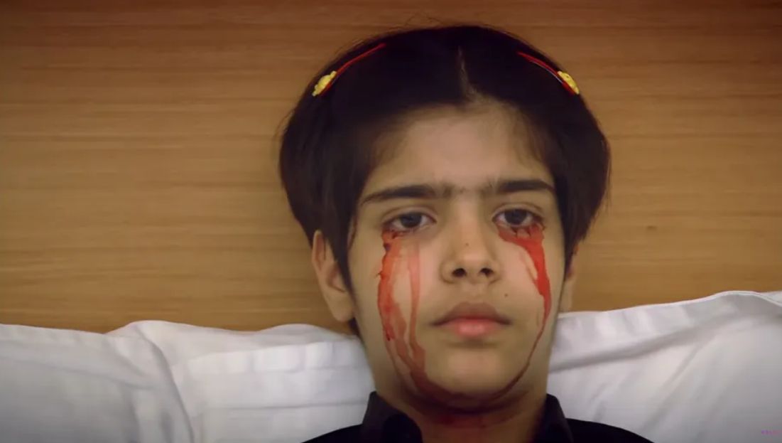 Dziewczynka płakała krwią. Rzadki przypadek medyczny