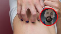 Takie objawy daje rak trzustki. "Okrada chorego z substancji odżywczych"