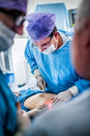 Modelowanie sylwetki za pomocą lasera. Rozpuść zbędne kilogramy!