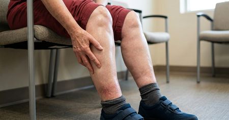 Pierwszy objaw zapchanych tętnic. Zwiastuje udar mózgu i zawał serca