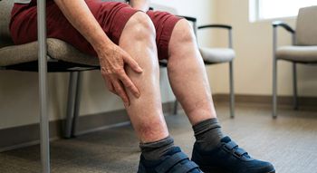 Pierwszy objaw zapchanych tętnic. Zwiastuje udar mózgu i zawał serca