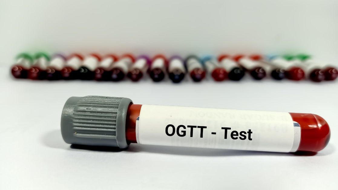 OGTT – badanie, wskazania, interpretacja